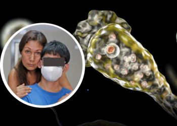 Menor va a la piscina y contrae ‘ameba comecerebros’