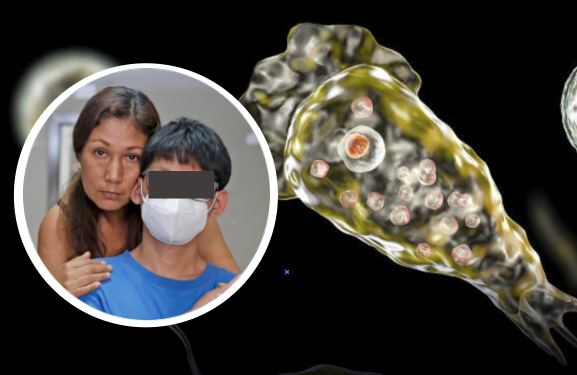 Menor va a la piscina y contrae ‘ameba comecerebros’