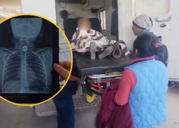 Cusco: Menor se traga moneda en su primer día de clases