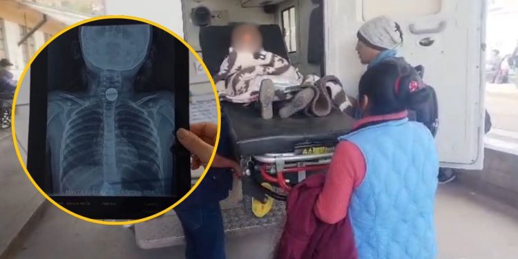 Cusco: Menor se traga moneda en su primer día de clases