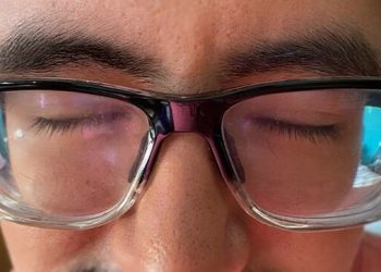 Minsa advierte sobre riesgos de síndrome del ojo seco