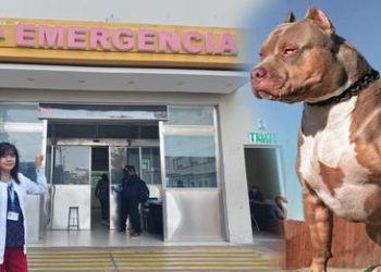 Arequipa: adulta mayor queda con el rostro desfigurado tras ser atacada por perro pitbull
