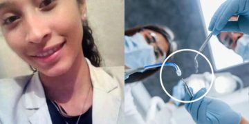 Joven enfermera fallece tras someterse a cirugía odontológica