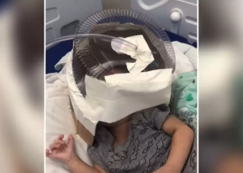 Médico salva vida de bebé usando envase de torta como máscara de oxígeno