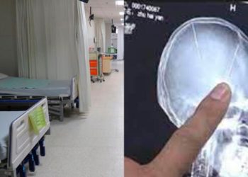 Niño acude al dentista y termina con una aguja en la cabeza