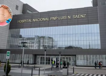 Mujer muere tras someterse a liposucción en Hospital Nacional PNP