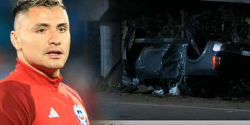 Arquero chileno sufrió grave accidente y tuvieron que amputarle el pie