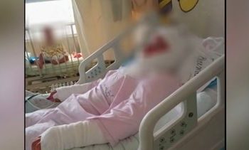 Menor sufre quemaduras en evento escolar: profesor le lanzó líquido por error