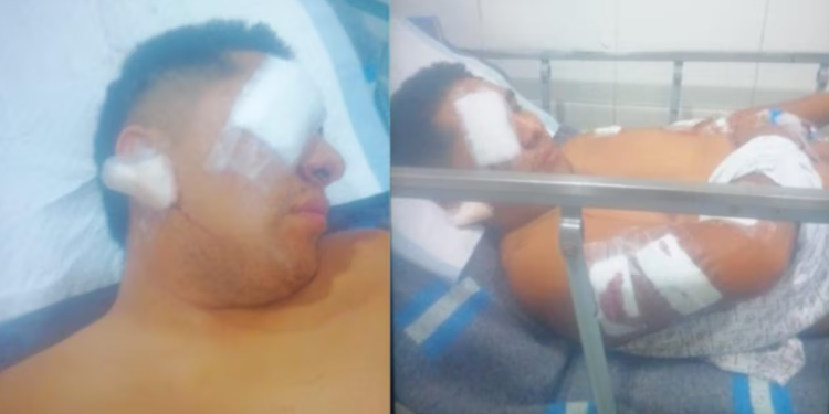 Ica: Mototaxista queda gravemente herido tras brutal ataque en Salas