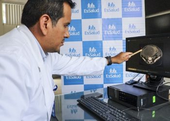 EsSalud: Médicos de Ica extirpan enorme tumor abdominal que simulaba un embarazo en una mujer de 39 años