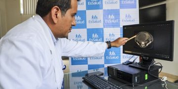 EsSalud: Médicos de Ica extirpan enorme tumor abdominal que simulaba un embarazo en una mujer de 39 años