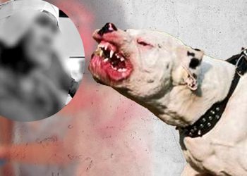 Docente en UCI tras brutal ataque de pitbull en Loreto