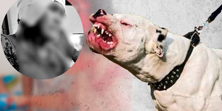 Docente en UCI tras brutal ataque de pitbull en Loreto