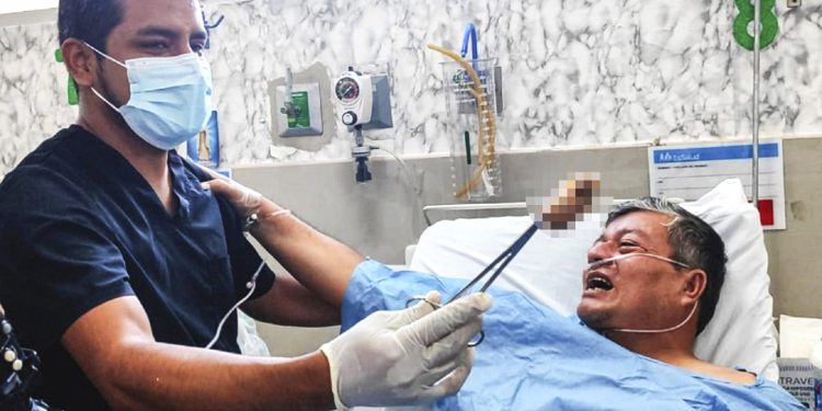 Hombre se salva de morir asfixiado por un trozo de chicharrón durante desayuno familiar