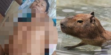Insólito caso en Loreto: confunden a pescador con un capibara y lo balean