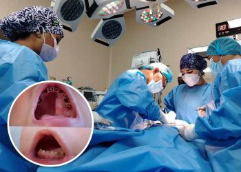 Crisis en salud bucal infantil: extraen 12 dientes a niño de 3 años por caries severa en Arequipa