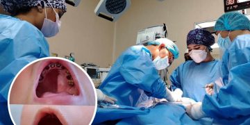 Crisis en salud bucal infantil: extraen 12 dientes a niño de 3 años por caries severa en Arequipa