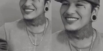 Muere joven de 24 años tras una infección en la muela que llegó a sus pulmones