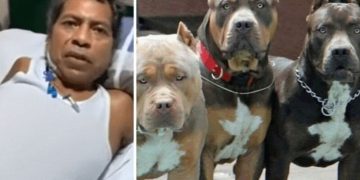 Padre de familia sufrió amputación de sus brazos tras ser atacado por 3 perros pitbulls: dueños no aceptan responsabilidad