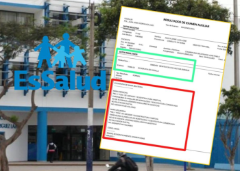 Paciente de EsSalud se hace examen de rodilla y le entregan “ecografía de mama»