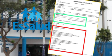 Paciente de EsSalud se hace examen de rodilla y le entregan “ecografía de mama»