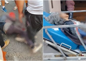 Ica: Anciana de 78 años es atropellada y conductor se dio a la fuga