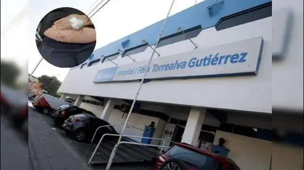 Ica: piden urgente traslado de trabajadora de camal con carbunco a hospital de Lima