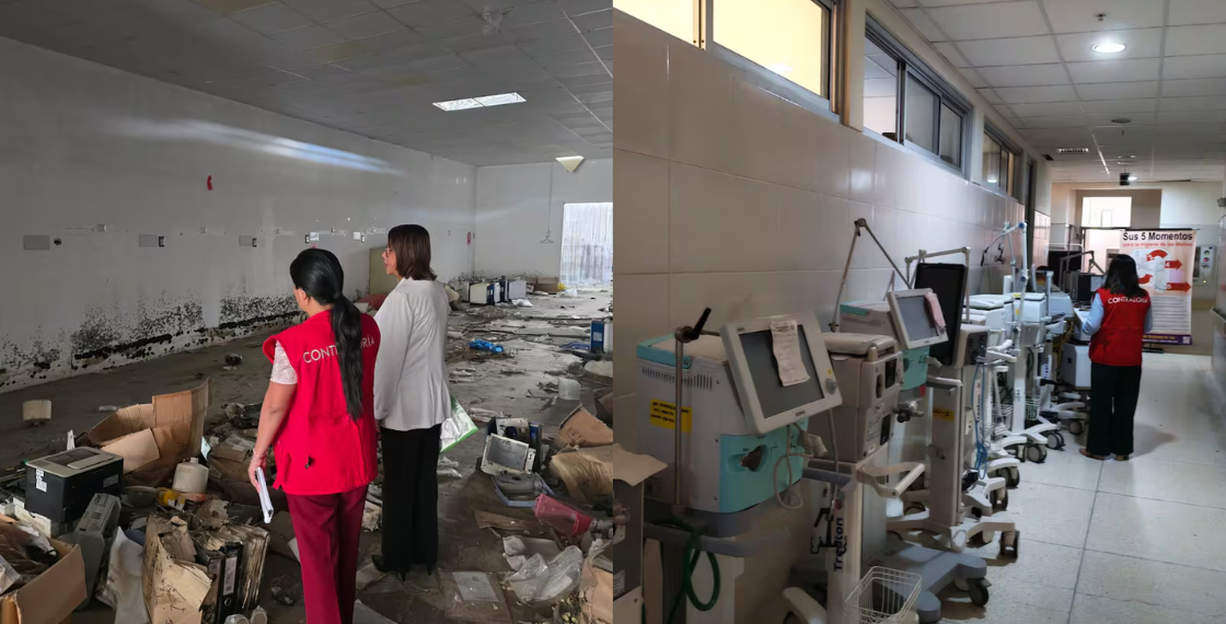 Contraloría detecta perjuicio de S/2.4 millones por ventiladores no ubicados en el Hospital Regional
