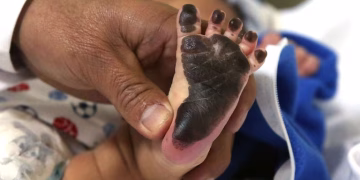Lima se queda sin hijos: el distrito donde la fecundidad no llega ni a un hijo por mujer